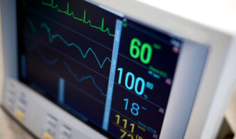 Electro - cardiography