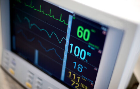Electro - cardiography